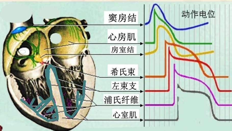 心脏不同部位生物电波形示意图.png